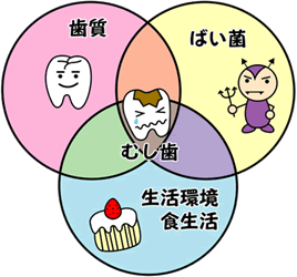 虫歯の原因:予防治療